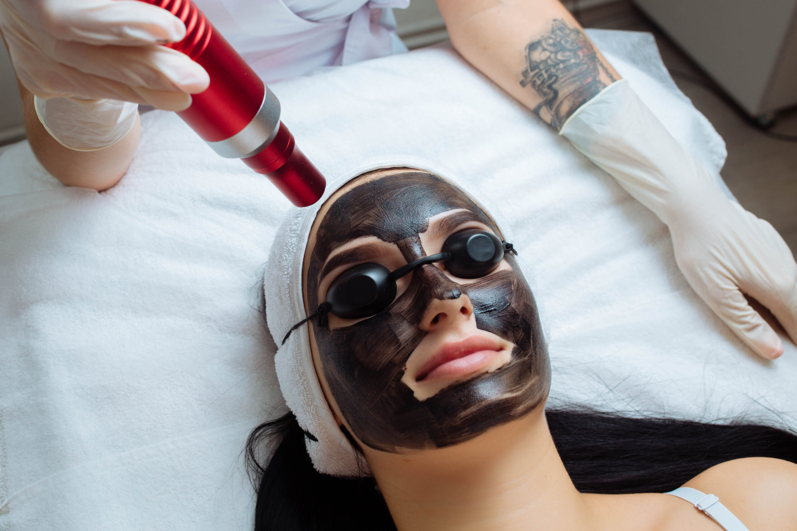 Close-up of cosmetologist's hand making hardware carbon peeling by young pretty customer woman in safety glasses headdress lying on couch in beauty salon. Facial cleaning concept. Cosmetology Services.
